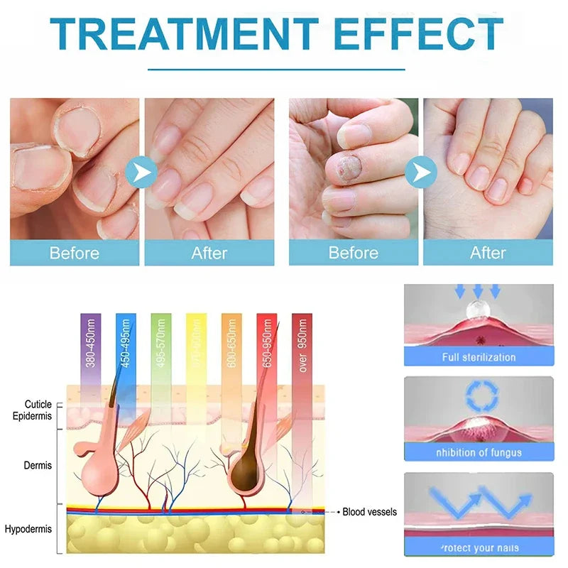 Blue Light Nail Care Set - photo 3