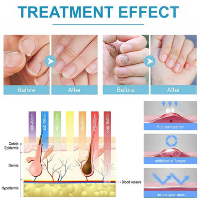 Blue Light Nail Care Set - photo 3